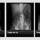 Illustration for article titled The Site Where Doctors Share X-Rays of Weird Things in People's Butts